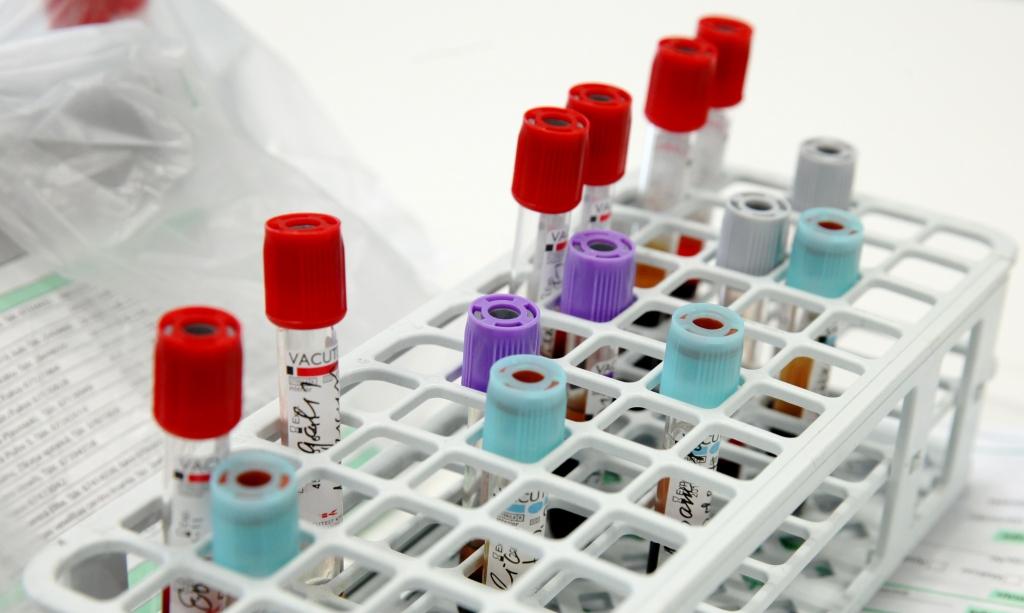 Dzen laboratoriskos izmeklējumus maksas sektorā