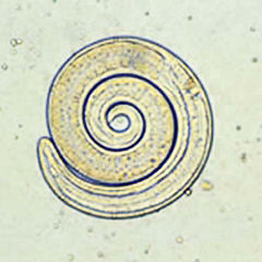 Bīstamā spirālīte