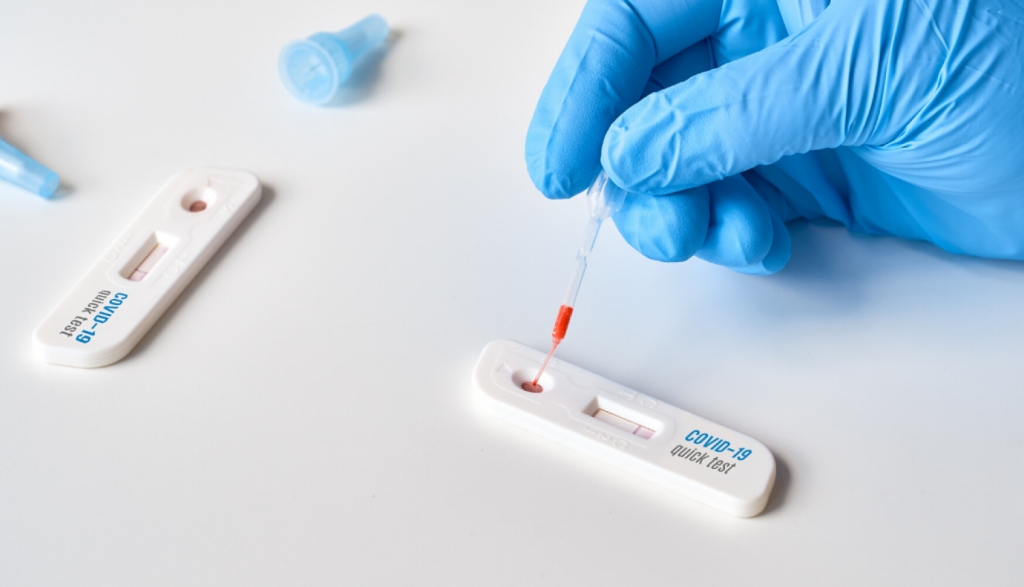 Covid-19 kontaktpersonas statusā nonākuši vakcinēti darbinieki un skolēni varēs neievērot karantīnu, veicot pārbaudi ar antigēna testiem